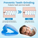 LAST DAY SALE 60% OFF⏰Perfect Solution- Anti-Snoring & Anti-Grinding Teeth Protector