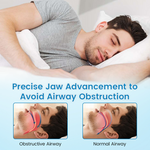 LAST DAY SALE 60% OFF⏰Perfect Solution- Anti-Snoring & Anti-Grinding Teeth Protector