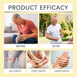 Bee Venom Joint Pain Relief Cream Joint &amp Bone Cream For Men Women Treatment